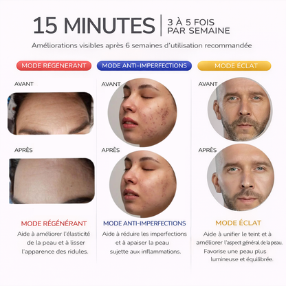 GLOMSY® LUMI FACE™ | MASQUE DE BEAUTÉ À LUMIÈRE LED